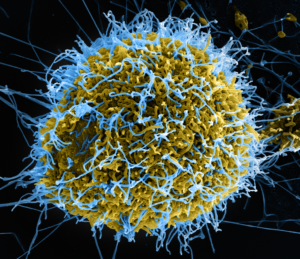 Ebola w Kenii